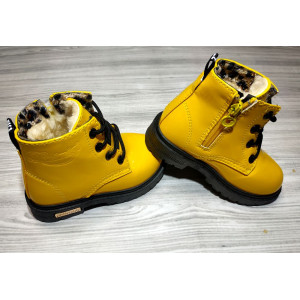 Лаковані черевики з хутром Dinimigi жовті
